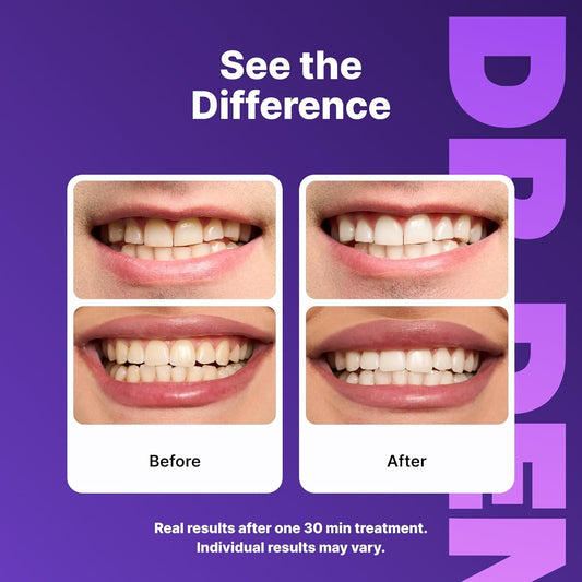 DrDent Purple Whitening Strips - Image 3